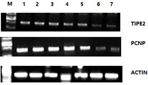 Reverse transcriptase PCR results of TIPE2 and PCNP in spleen cells of CIA mice and normal mice.