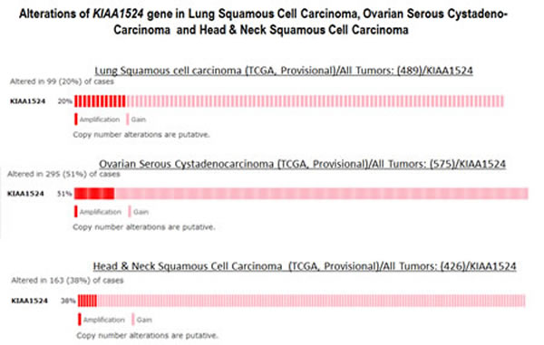 Alterations (Amplification and Gain) of KIAA1524 gene in Lung Squamous Cell Carcinoma (TCGA, Provisional), Ovarian Serous Cystadenocarcinoma (TCGA, Provisional) and Head &amp; Neck Squamous Cell Carcinoma (TCGA, Provisional).