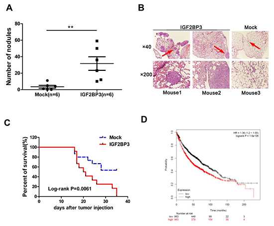 Overexpression of IGF2BP3 promotes lung cancer metastasis and limits survival time.