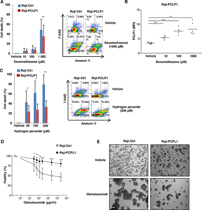 PCLP1 provides resistance to dexamethasone, reactive oxygen species and obinutuzumab-induced death in B-cell lymphoma cells.