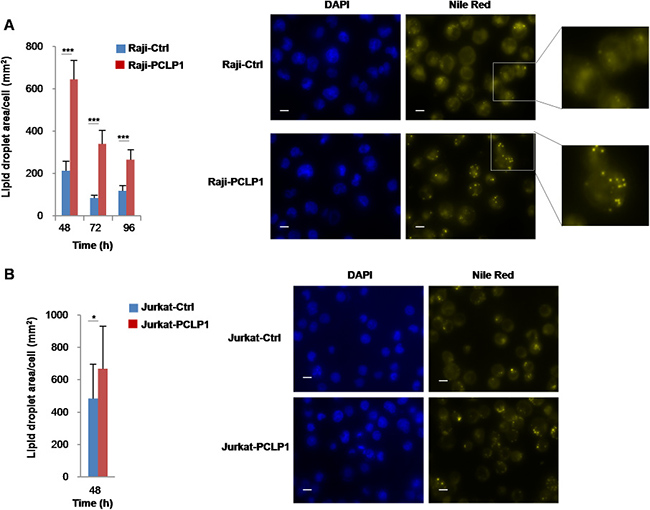 PCLP1 induces lipid droplet synthesis.