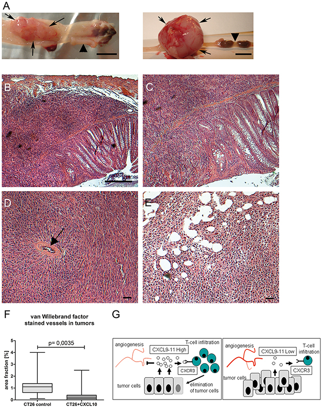 CXCL10-chemokine expression in orthotopic mouse model has anti-tumoral effect.