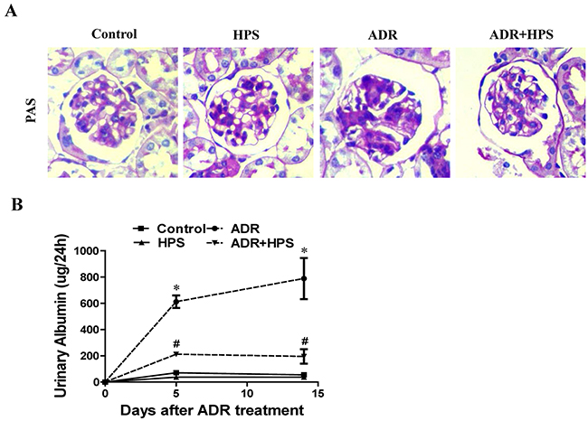 Effect of hyperoside on adriamycin-induced kidney injury and albuminuria in vivo.