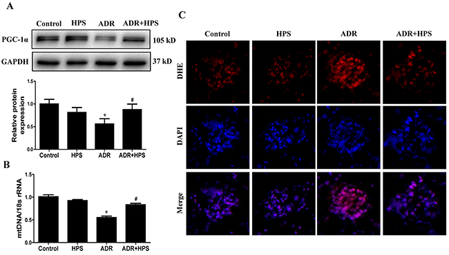 Effect of hyperoside on adriamycin-induced mitochondrial dysfunction in vivo.