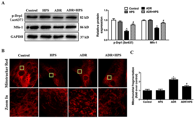 Effect of hyperoside on adriamycin-induced mitochondrial fission in vitro.