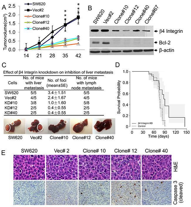 Figure 5:Stable knockdown of &beta;4-integrin showed decreased tumorigenicity and liver metastasis.