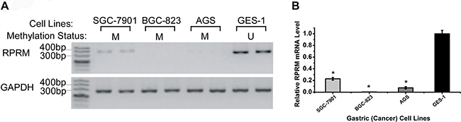 The RPRM mRNA expression in four cell lines.
