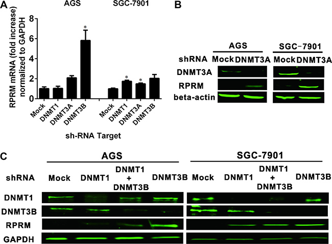 The relationship between DNMTs and RPRM expression evaluated by RNA interference and gene expression.