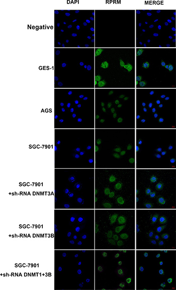Immunofluorescence analyses of the expression and localization of RPRM in GES-1, AGS, SGC-7901, and SGC-7901 cells after RNAi knockdown of various DNMTs.