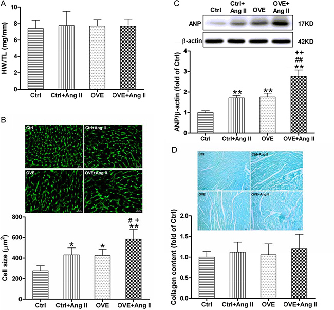Effect of acute Ang II on the cardiac hypertrophy in diabetic OVE26 mice.