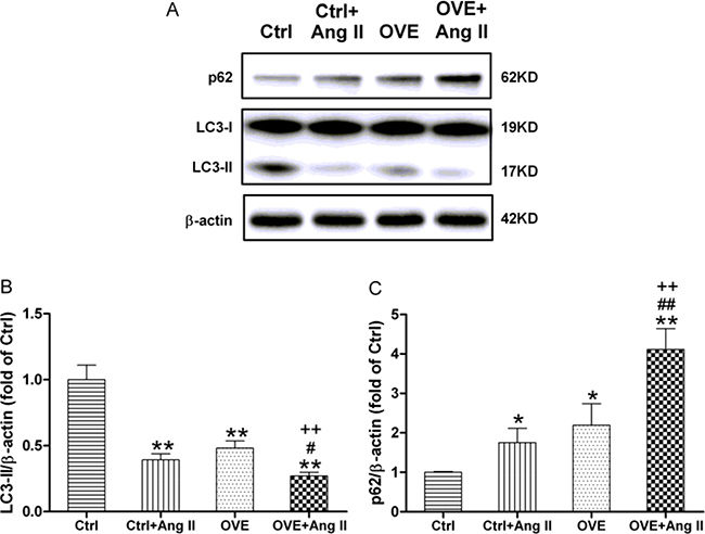 Effect of acute Ang II on the LC3 and p62 expressions in diabetic OVE26 mice hearts.