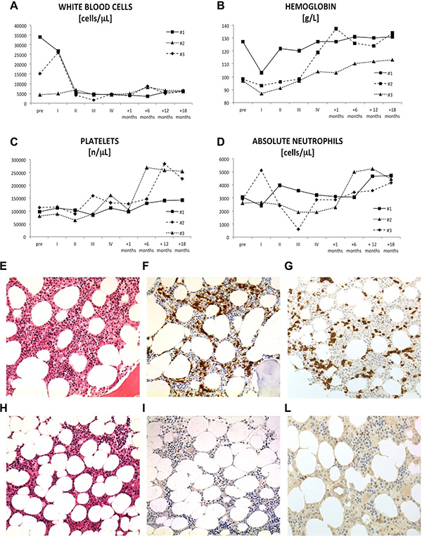 Complete blood count values and bone marrow biopsy.