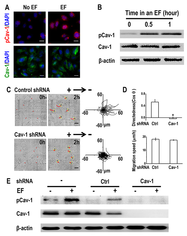 Caveolin-1 plays an essential role in electrotaxis of H1650-M3 cells.