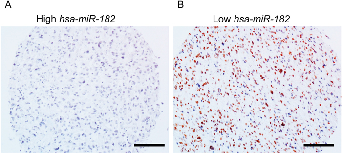 PPP1R1C and miR-182 are inversely correlated in patients with GBM.