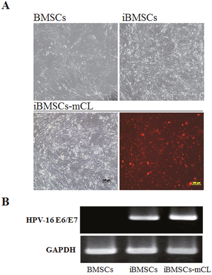 Characterization of immortalized human bone marrow mesenchymal stem cells (iBMSCs).