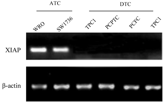 XIAP was abundantly expressed in the ATC cell lines WRO and SW1736, whereas, no expression was found in DTC cell lines.