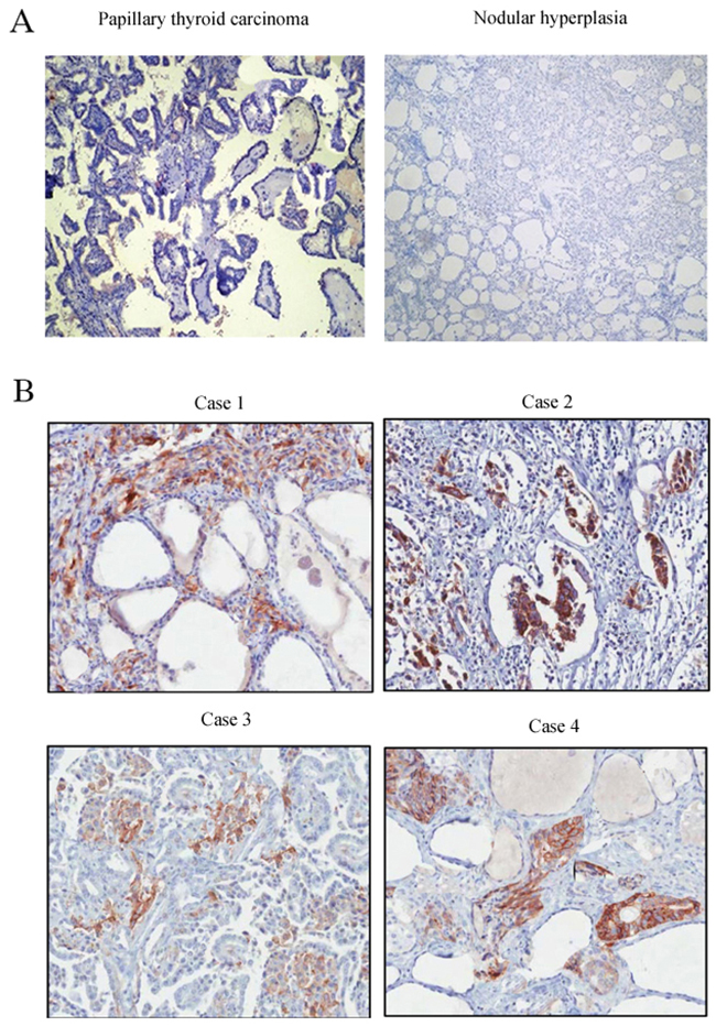 Immunohistochemical staining of XIAP in different tissues.