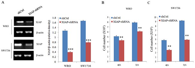 Cell proliferation evaluation in ATC cell lines after XIAP shRNA transfection.