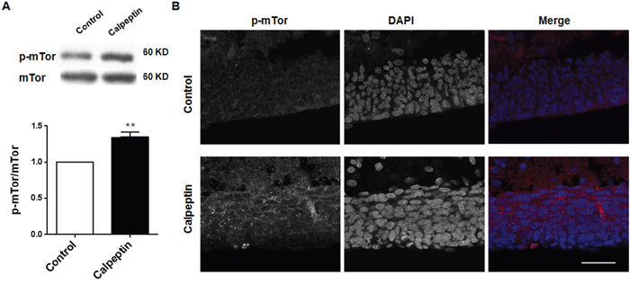 Postnatal application of calpeptin promotes mammalian target of rapamycin (mTor) phosphorylation.