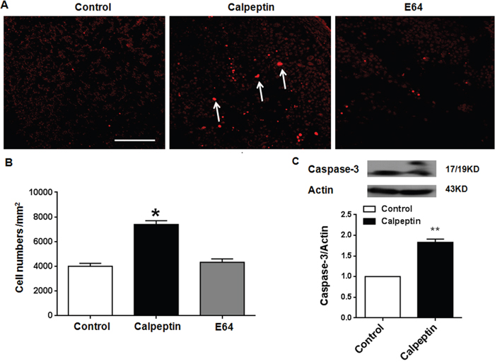 Postnatal application of calpeptin promotes apoptosis.