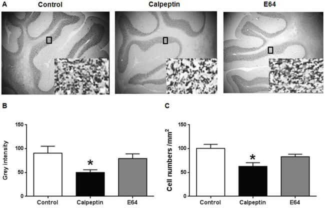 Postnatal application of calpeptin reduces the numbers of cerebellar granular cells.