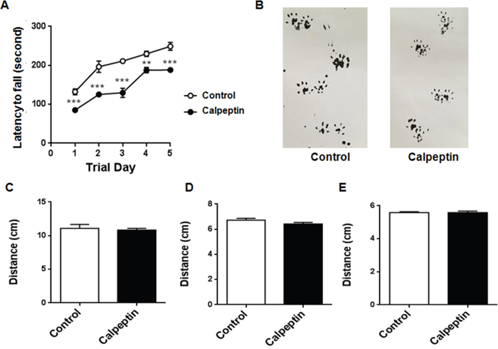 Postnatal application of calpeptin alters the motor function.