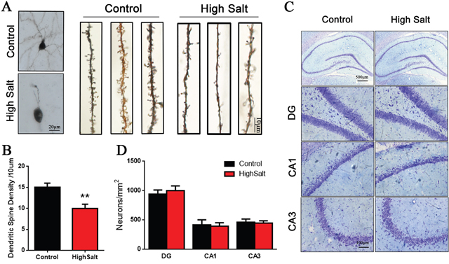 Loss of dendritic spines in the high saline-administrated rats.