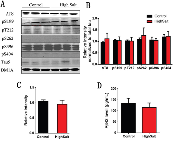 No change of Tau and A&#x03B2; in hippocampus of high salt diet.