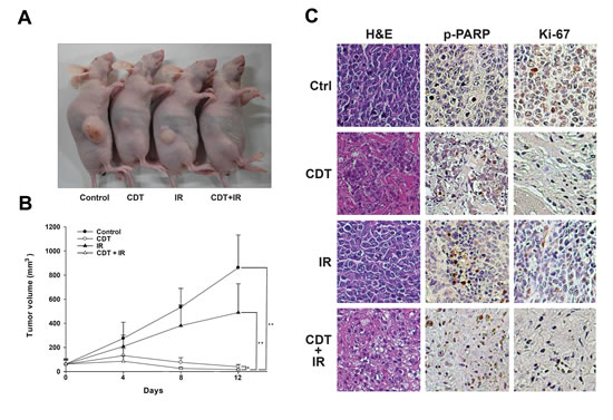 CDT synergistically enhanced IR-attenuated PCa growth in a mouse xenograft model.