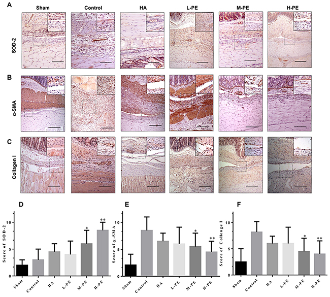 Immunohistochemical staining of SOD-2, &#x03B1;-SMA and collagen I in the postoperative peritoneal adhesions or the damaged areas on the opposing parietal peritoneum in each group of rats (100&#x00D7; magnification in the upper row, 200&#x00D7; magnification in the upper left corner).