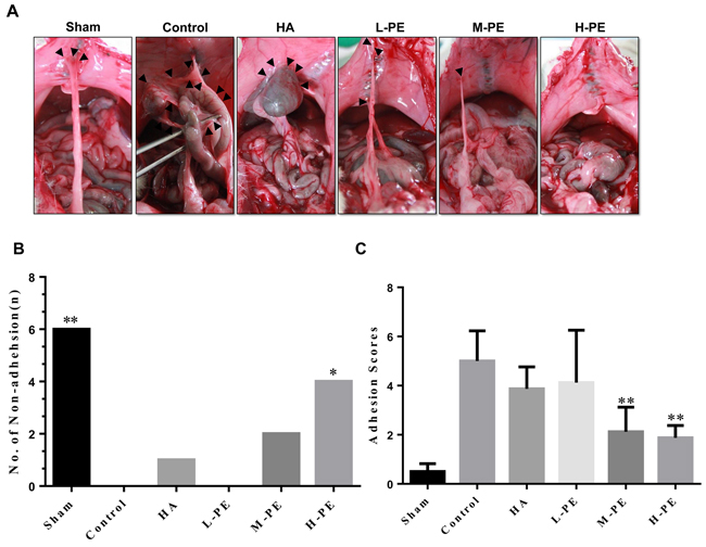 The administration of different concentrations of PE and sodium HA prevented postoperative abdominal adhesion formation in this rat model.