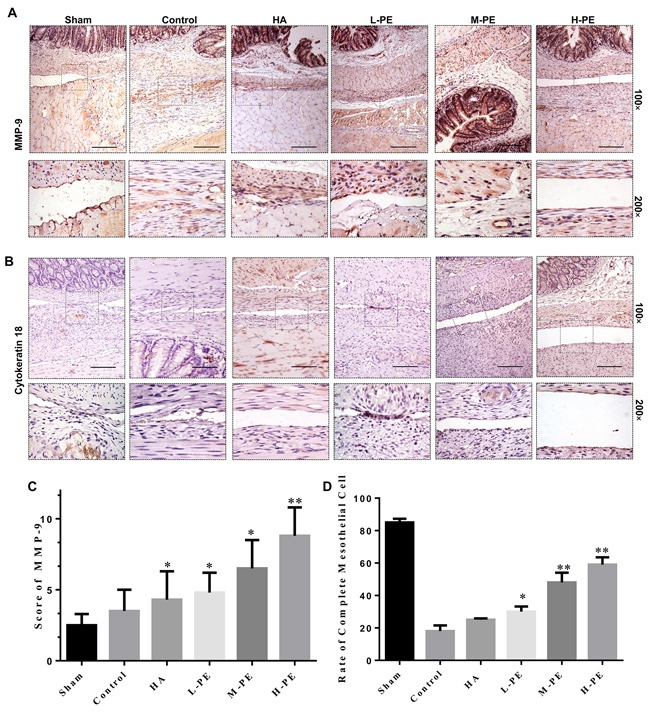 Immunohistochemical staining of MMP-9 and cytokeratin in the postoperative peritoneal adhesions or the damaged areas on the opposing parietal peritoneum in each group of rats (100&#x00D7; magnification in the upper row, and 200&#x00D7; magnification in the bottom row).
