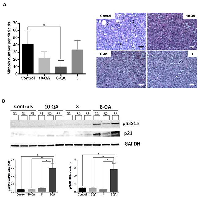 Characterization of in vivo antitumor efficacy.