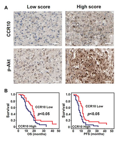 CCR10 expression positively correlate with p-Akt and correlated with poor survival in GBM.