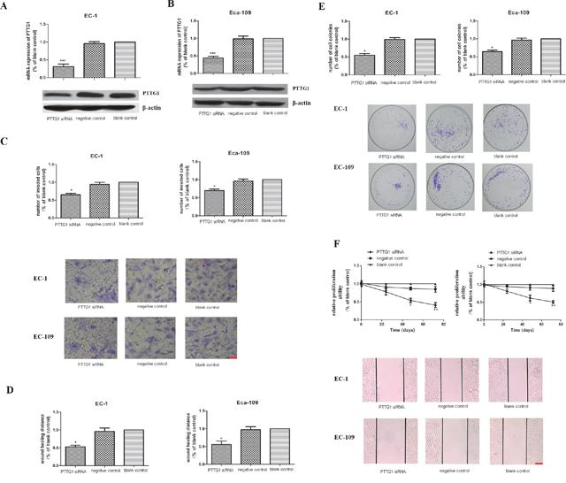 The role of PTTG1 in the invasion, migration and proliferation abilities in EC-1 and EC-109 cells in vitro.