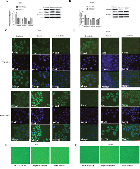 Down regulation of PTTG1 altered the expression of E-cadherin, vimentin and N-cadherin.