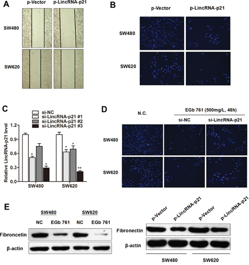 EGb 761 inhibits metastasis of colorectal cancer cells through upregulation of LincRNA-p21.