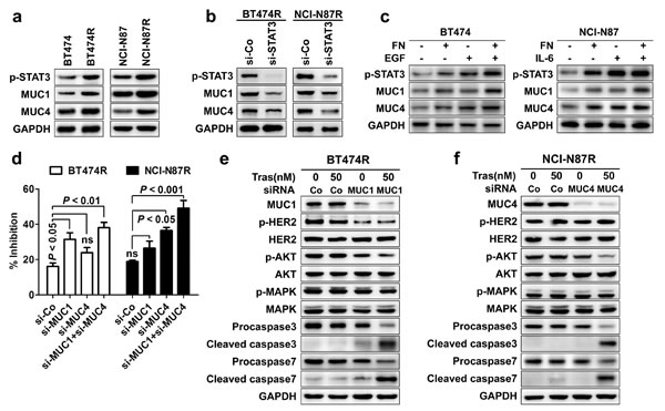 STAT3 upregulates the expression of MUC1 and MUC4 that mediates trastuzumab resistance.