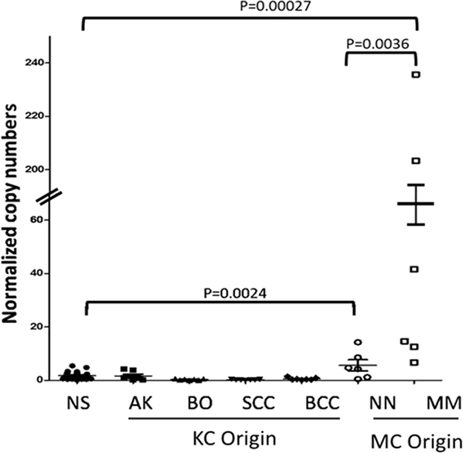 EYA1 expression in melanocytic and non-melanocytic skin tissues.