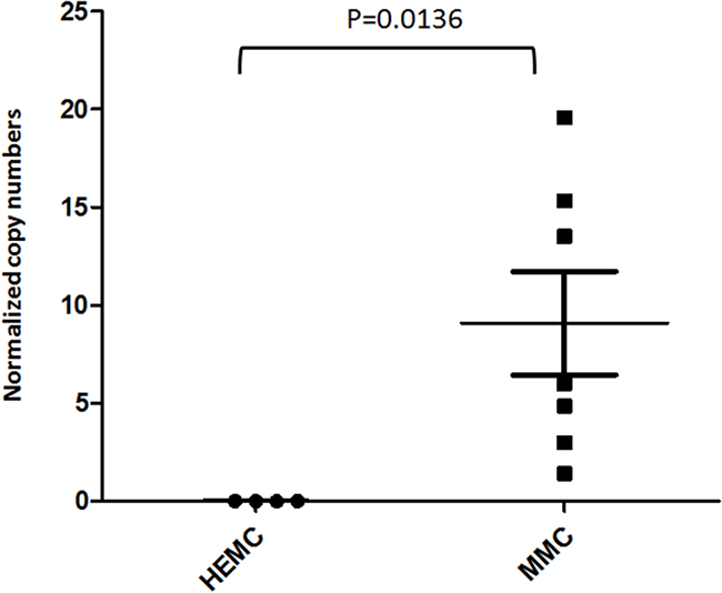 EYA1 upregulation is preserved in melanoma cell lines.