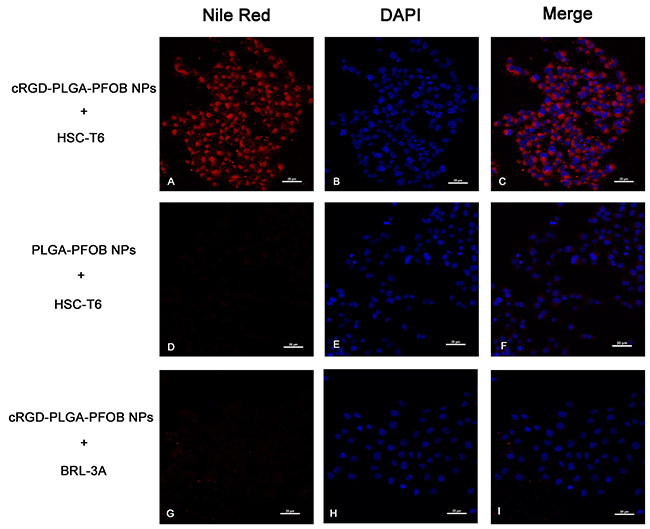 In vitro targeting performance of cRGD-PLGA-PFOB NPs to HSC-T6 cells (magnification &#x00D7;400).