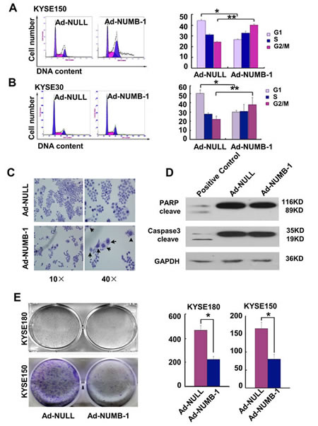 Fig.4: Overexpression of NUMB-1 suppresses KYSE150 cell growth by arresting cells in M phase.