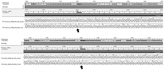 Genetic sequencing showing mutation (arrows) in exon 2 of KRAS gene in culture of LLC cells and tumor tissue of mice after LLC cells implantation.