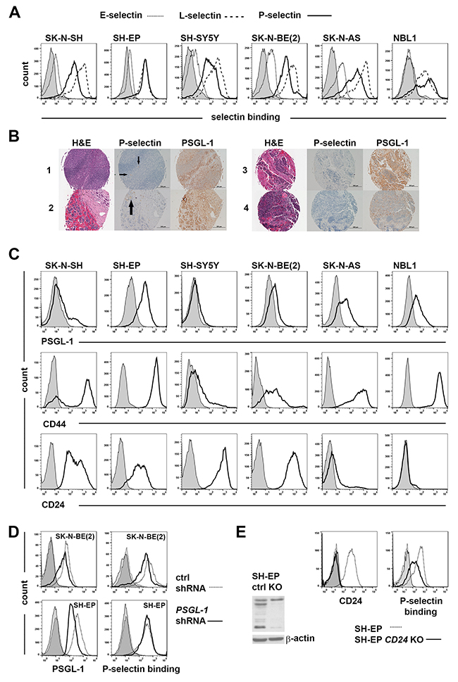 Redundant use of selectin ligands by neuroblastoma cells.