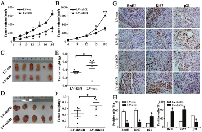 Klf4 suppressed tumor growth of NPC cells in nude mice.