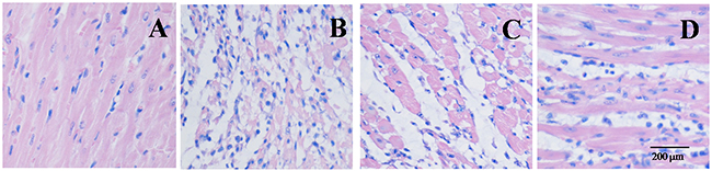 EGb 761 inhibited infiltration of inflammatory cells in Myocardial Histology.