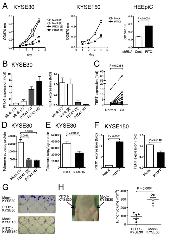 Ectopic expression of PITX1 suppressed ESCC cell growth in vitro and in vivo.