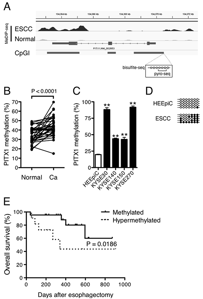 DNA hypermethylation of PITX1 is correlated with a poor prognosis of ESCC.
