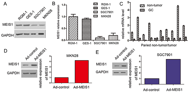 MEIS1 expresses in GC cell line SGC7901, MKN28, and normal gastric cell line RGM-1, and GES-1.