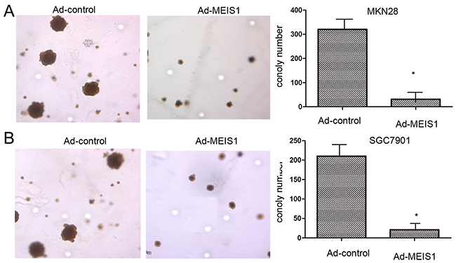 MEIS1 inhibits anchorage-independent growth of GC cells.